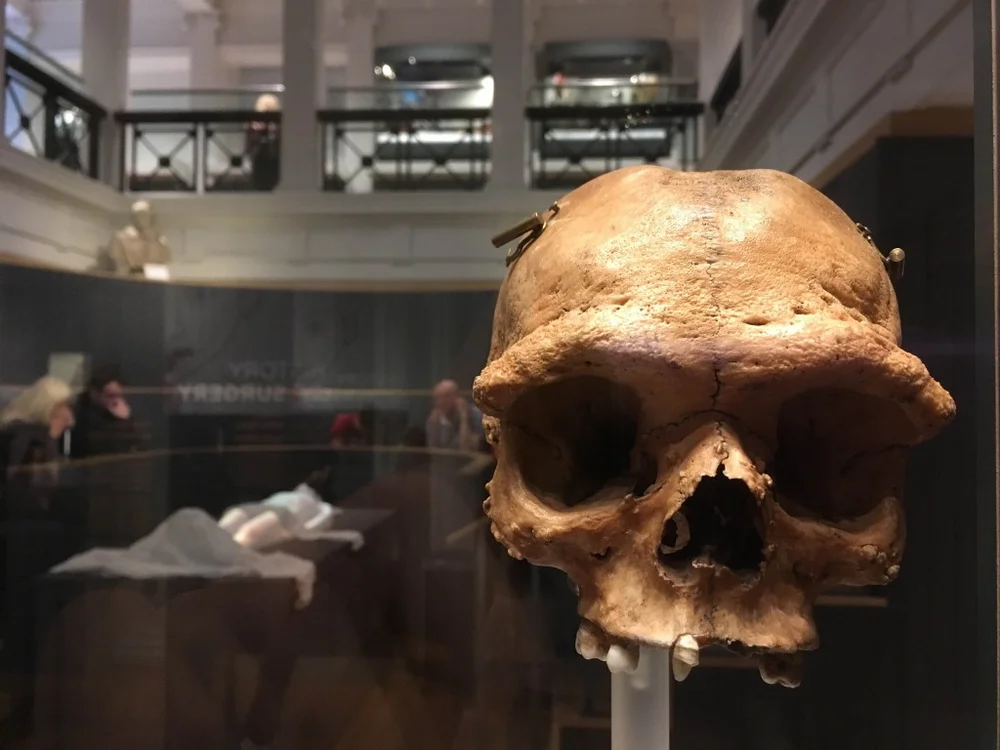 Surgeons Hall Museum Edinburgh